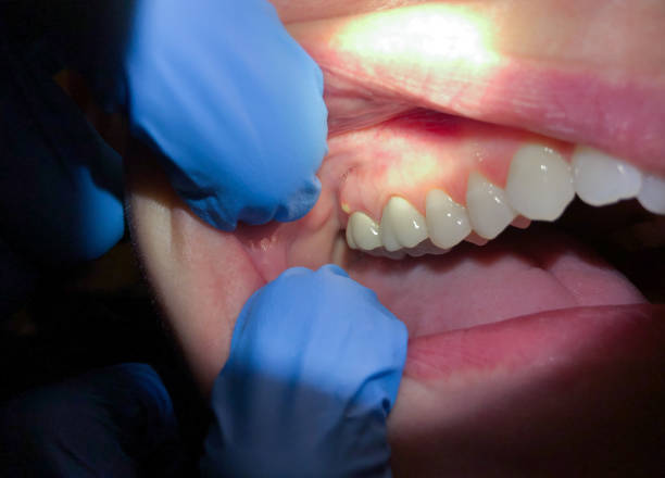 Best Weekend Emergency Dentist in Midway, KY