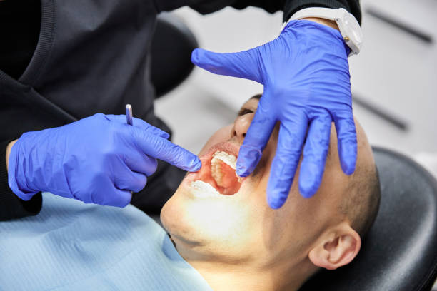 Best Emergency Wisdom Teeth Removal in Midway, KY