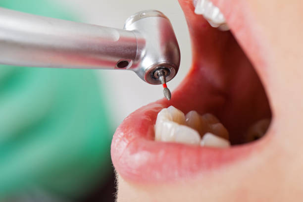 Best Pediatric Emergency Dentist in Midway, KY